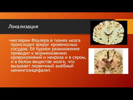 Локализация неглерии Фоулера в тканях мозга происходит вокруг кровеносных сосудов. Её бурное