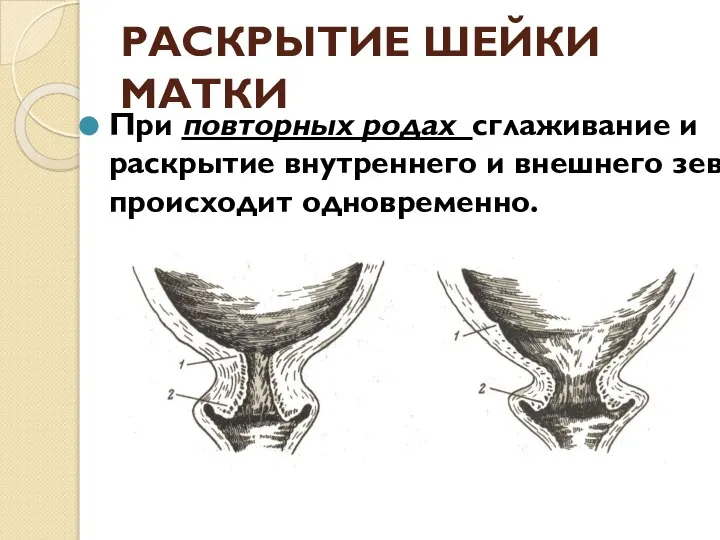 РАСКРЫТИЕ ШЕЙКИ МАТКИ При повторных родах сглаживание и раскрытие внутреннего и внешнего зева происходит одновременно.