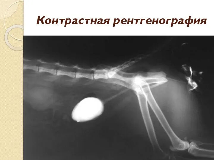 Контрастная рентгенография