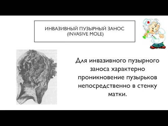 ИНВАЗИВНЫЙ ПУЗЫРНЫЙ ЗАНОС (INVASIVE MOLE) Для инвазивного пузырного заноса характерно проникновение пузырьков непосредственно в стенку матки.