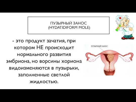 ПУЗЫРНЫЙ ЗАНОС (HYDATIDIFORM MOLE) - это продукт зачатия, при котором НЕ происходит