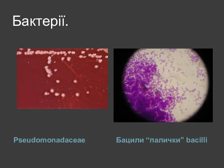 Бактерії. Pseudomonadaceae Бацили “палички” bacilli