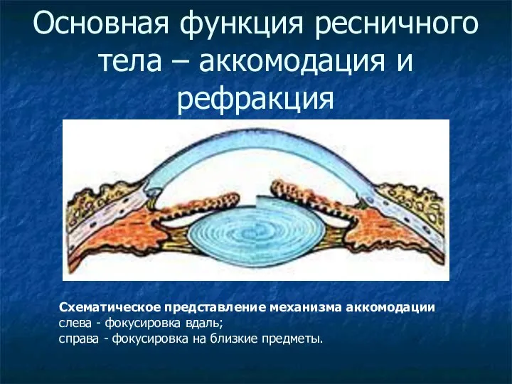 Основная функция ресничного тела – аккомодация и рефракция Схематическое представление механизма аккомодации