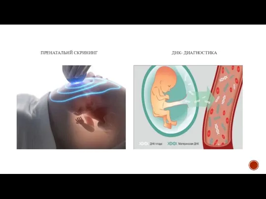 ПРЕНАТАЛЬНЙ СКРИНИНГ ДНК- ДИАГНОСТИКА