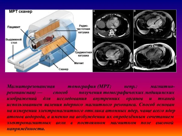 Магниторезонансная томография (МРТ; непр.: магнитно-резонансная) — способ получения томографических медицинских изображений для