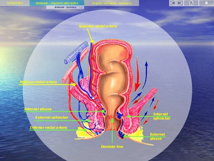 Rationale - Anatomic description Rationale - Summary Introduction Surgical Technique - Summary X