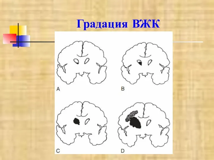 Градация ВЖК