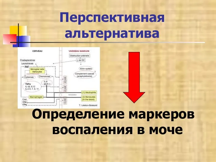 Перспективная альтернатива Определение маркеров воспаления в моче