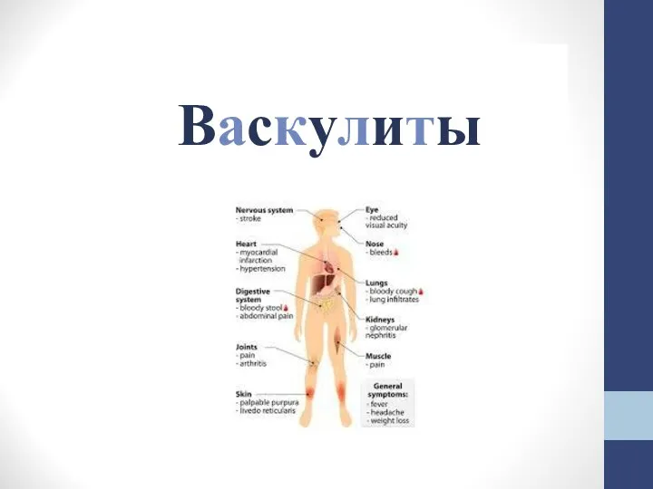 Васкулиты