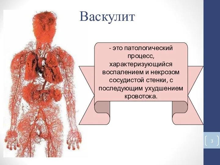 Васкулит - это патологический процесс, характеризующийся воспалением и некрозом сосудистой стенки, с последующим ухудшением кровотока.