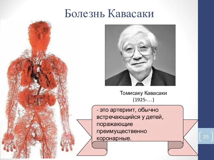 Болезнь Кавасаки - это артериит, обычно встречающийся у детей, поражающие преимущественно коронарные. Томисаку Кавасаки (1925-…)