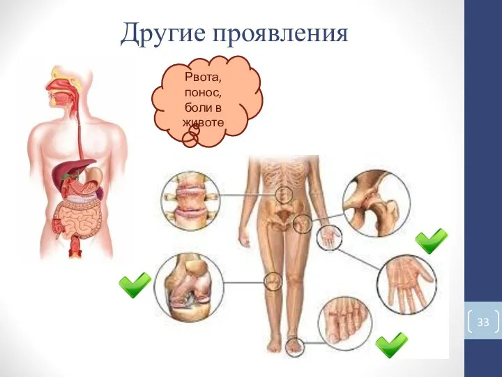 Другие проявления Рвота, понос, боли в животе