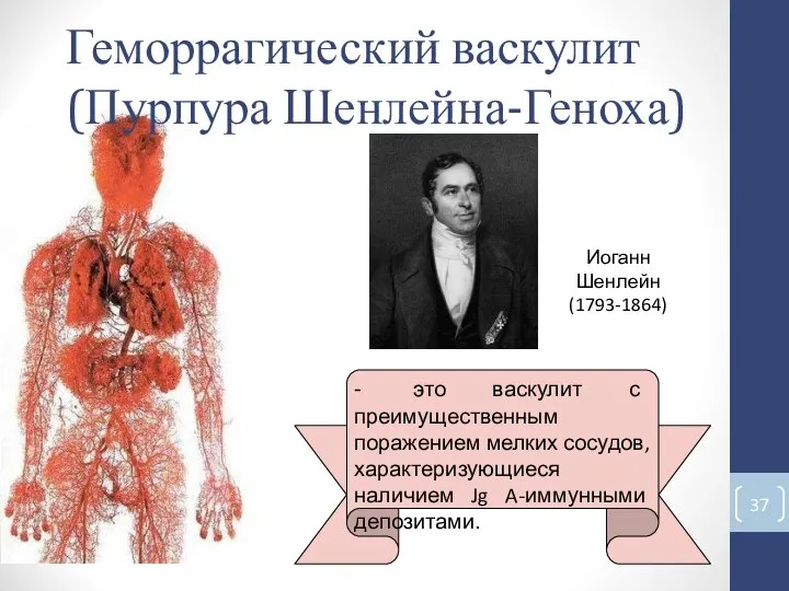 - это васкулит с преимущественным поражением мелких сосудов, характеризующиеся наличием Jg A-иммунными