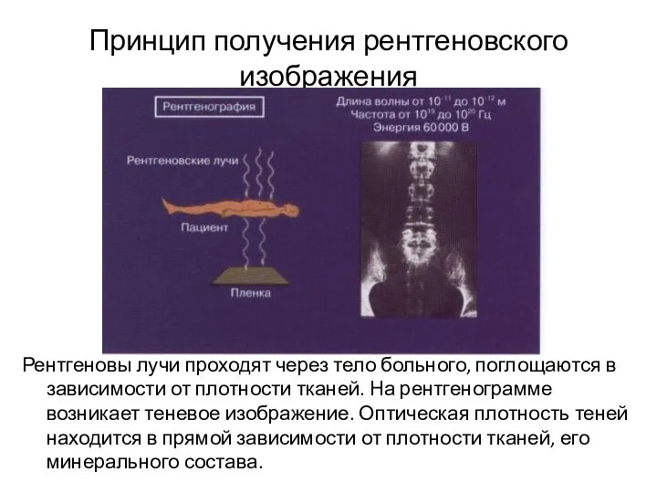Принцип получения рентгеновского изображения Рентгеновы лучи проходят через тело больного, поглощаются в