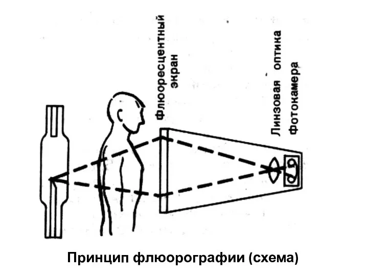 Принцип флюорографии (схема)