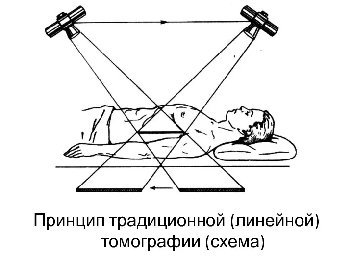 Принцип традиционной (линейной) томографии (схема)