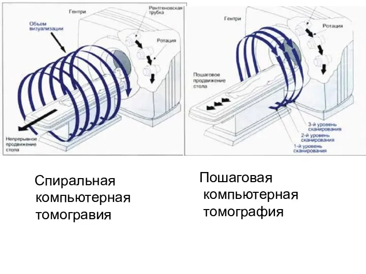 Спиральная компьютерная томогравия Пошаговая компьютерная томография