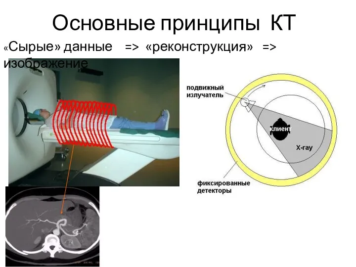 Основные принципы КТ «Сырые» данные => «реконструкция» => изображение