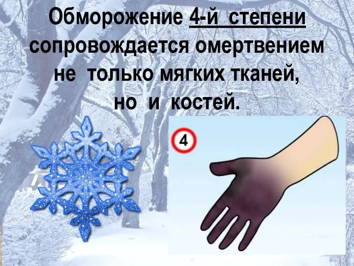 Обморожение 4-й степени сопровождается омертвением не только мягких тканей, но и костей.