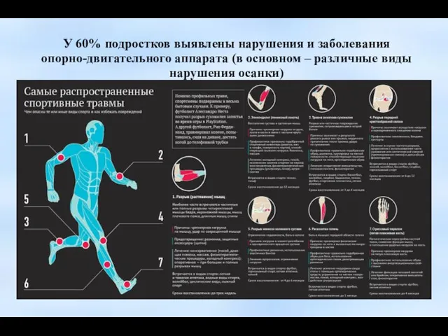 У 60% подростков выявлены нарушения и заболевания опорно-двигательного аппарата (в основном –