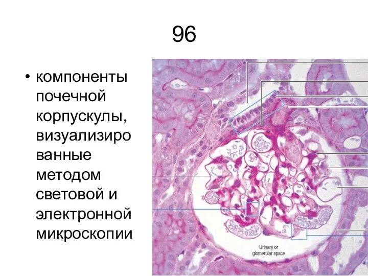 96 компоненты почечной корпускулы, визуализированные методом световой и электронной микроскопии
