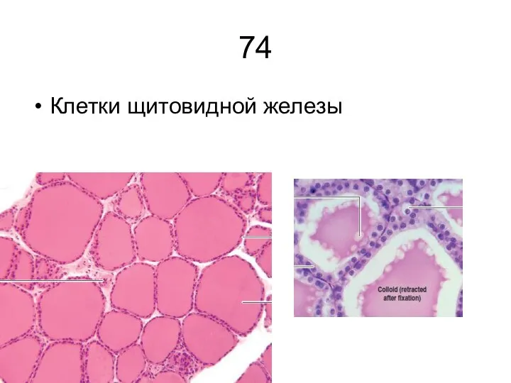 74 Клетки щитовидной железы