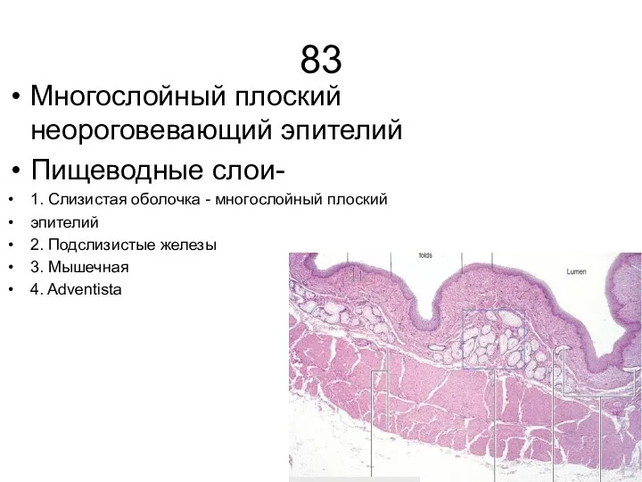 83 Многослойный плоский неороговевающий эпителий Пищеводные слои- 1. Слизистая оболочка - многослойный