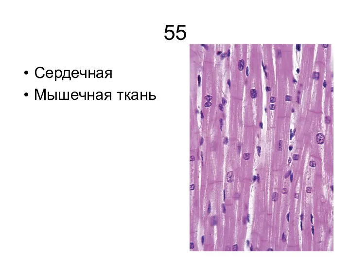 55 Сердечная Мышечная ткань