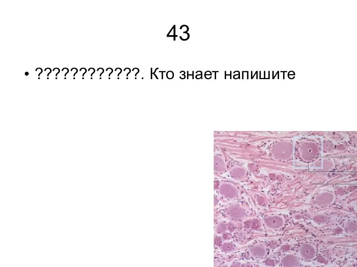 43 ????????????. Кто знает напишите