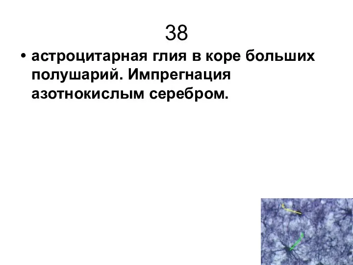 38 астроцитарная глия в коре больших полушарий. Импрегнация азотнокислым серебром.