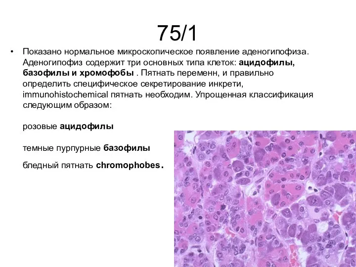 75/1 Показано нормальное микроскопическое появление аденогипофиза. Аденогипофиз содержит три основных типа клеток: