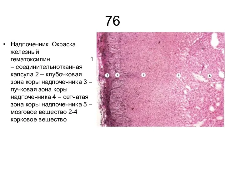 76 Надпочечник. Окраска железный гематоксилин 1 – соединительнотканная капсула 2 – клубочковая