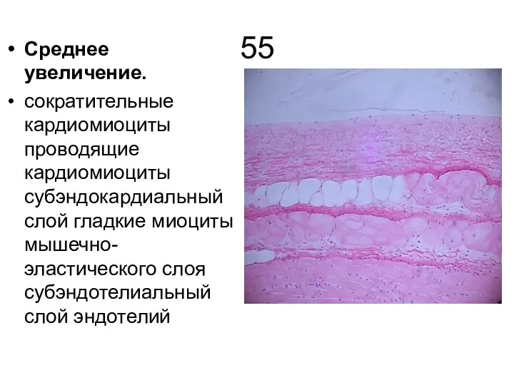 55 Среднее увеличение. сократительные кардиомиоциты проводящие кардиомиоциты субэндокардиальный слой гладкие миоциты мышечно-эластического слоя субэндотелиальный слой эндотелий