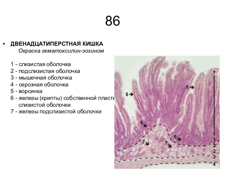 86 ДВЕНАДЦАТИПЕРСТНАЯ КИШКА Окраска гематоксилин-эозином 1 - слизистая оболочка 2 - подслизистая