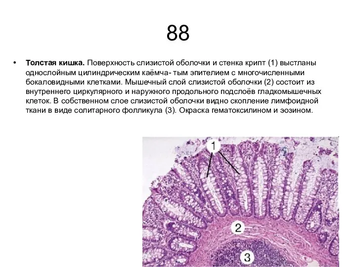 88 Толстая кишка. Поверхность слизистой оболочки и стенка крипт (1) выстланы однослойным