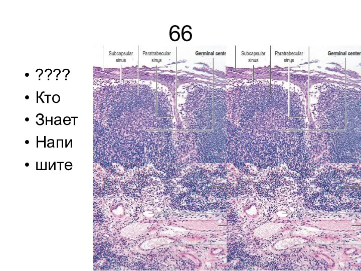 66 ???? Кто Знает Напи шите