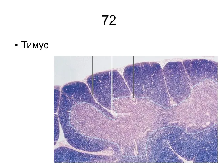 72 Тимус