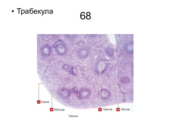 68 Трабекула