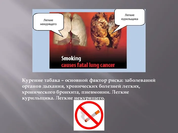 Курение табака – основной фактор риска: заболеваний органов дыхания, хронических болезней легких,