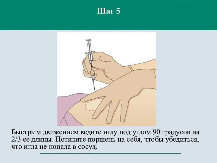 Быстрым движением ведите иглу под углом 90 градусов на 2/3 ее длины.