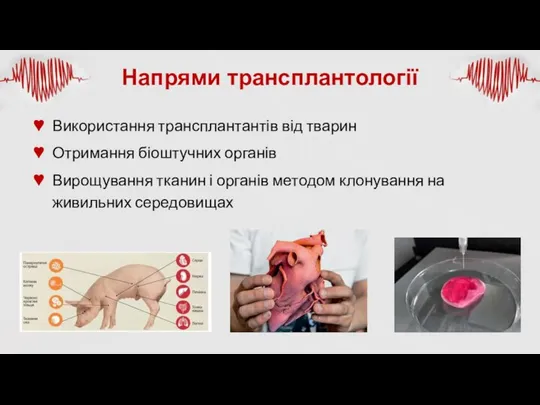 Напрями трансплантології Використання трансплантантів від тварин Отримання біоштучних органів Вирощування тканин і