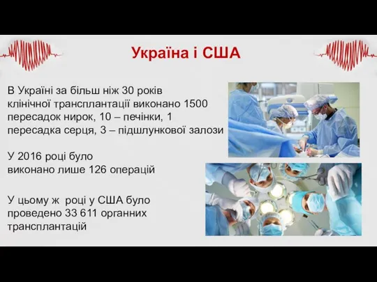 В Україні за більш ніж 30 років клінічної трансплантації виконано 1500 пересадок
