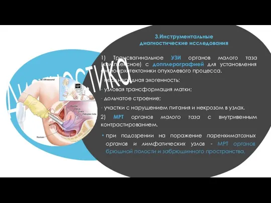 Диагностика 1) Трансвагинальное УЗИ органов малого таза (комплексное) с допплерографией для установления