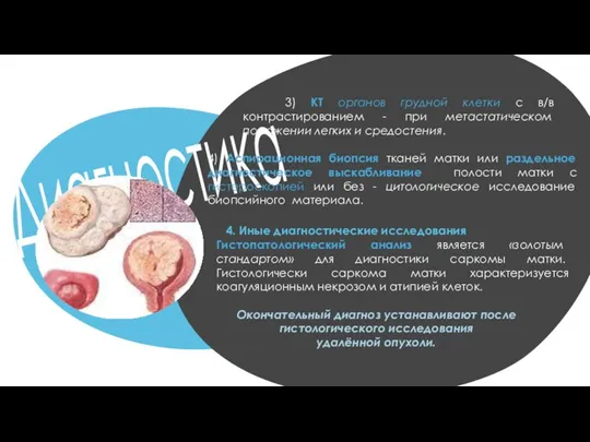 Диагностика 3) КТ органов грудной клетки с в/в контрастированием - при метастатическом