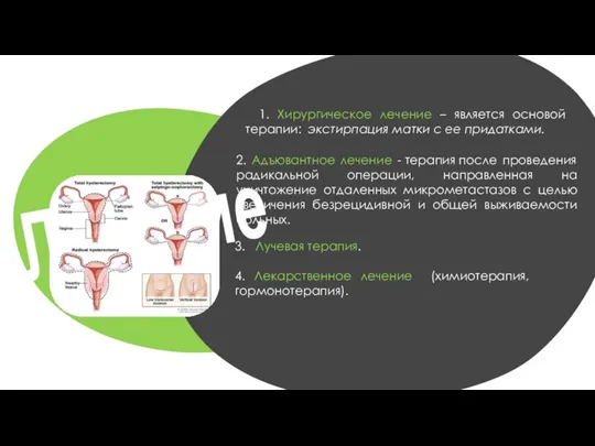 Лечение 1. Хирургическое лечение – является основой терапии: экстирпация матки с ее