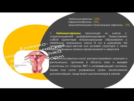 Клинико- морфологическая характеристика отдельных форм 1. Лейомиосаркомы происходят из клеток с гладкомышечной