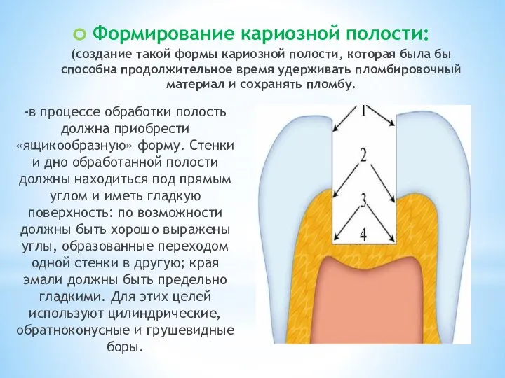 Формирование кариозной полости: (создание такой формы кариозной полости, которая была бы способна