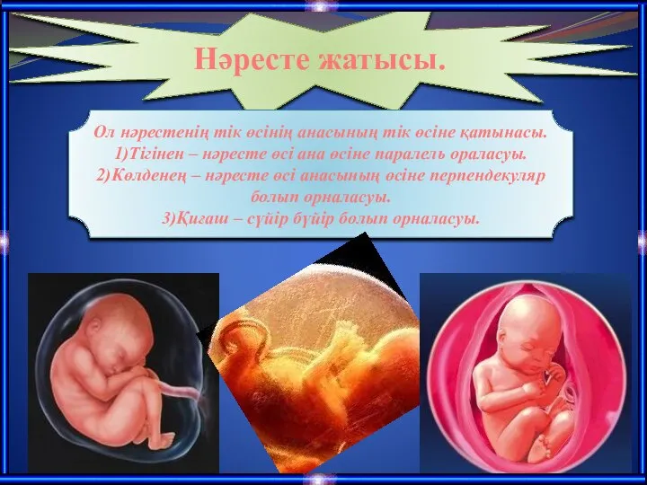 Нәресте жатысы. Ол нәрестенің тік өсінің анасының тік өсіне қатынасы. 1)Тігінен –