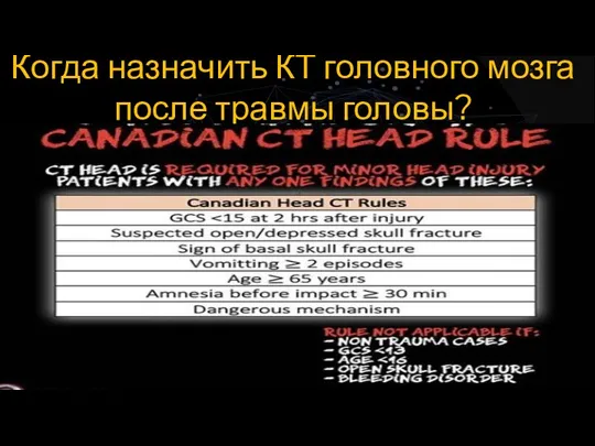 Когда назначить КТ головного мозга после травмы головы?