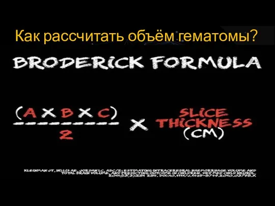 Как рассчитать объём гематомы?